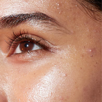 BLEMISHES & ENLARGED PORES
