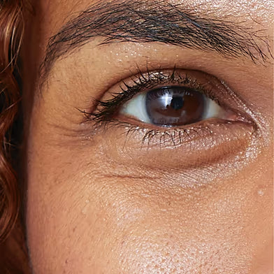 FINE LINES & WRINKLES