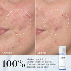 Press & Clear™ (Travel Size)